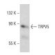 TRPV5 Antibody (B-6) - Western Blotting - Image 387361