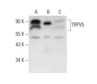 TRPV5 Antibody (B-8) - Western Blotting - Image 303836 