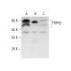 TRPV5 Antibody (B-8) - Western Blotting - Image 303836 