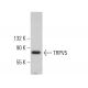 TRPV5 Antibody (B-8) - Western Blotting - Image 375387
