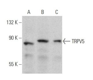 western blotting image from recommended TRPV5 (B-6) monoclonal antibody replacement. Image 359927