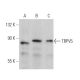 western blotting image from recommended TRPV5 (B-6) monoclonal antibody replacement. Image 359927