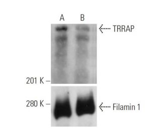 TRRAP siRNA (h): sc-36746. Western blot analysis of TRRAP expression in non-transfected control (A) and TRRAP siRNA transf 