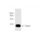 This polyclonal antibody has been discontinued. See our recommended <a href="trypsin-antibody-d-1">Trypsin (D-1)</a> monoclonal antibody (sample data shown). western blotting image from recommended Trypsin (D-1) monoclonal antibody replacement. Image 56449