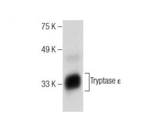 Tryptase &epsilon; Antibody (G-9) - Western Blotting - Image 284490 
