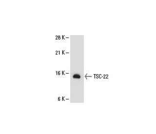 TSC-22 Antibody (R5-6) - Western Blotting - Image 21423 