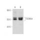 TSEN54 Antibody (A-9) - Western Blotting - Image 388995