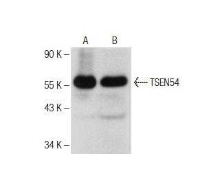 TSEN54 Antibody (C-1) - Western Blotting - Image 151041 