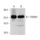 TSEN54 Antibody (C-1) - Western Blotting - Image 151041 