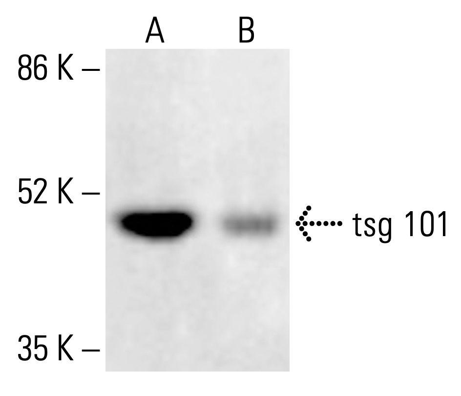 グレートムタ　３点 tsg 101 Antibody (51) | SCBT - Santa Cruz Biotechnology
