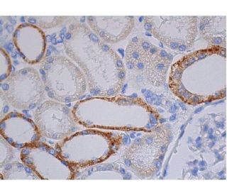 tsg 101 Antibody (C-2) - Immunohistochemistry - Image 354226 