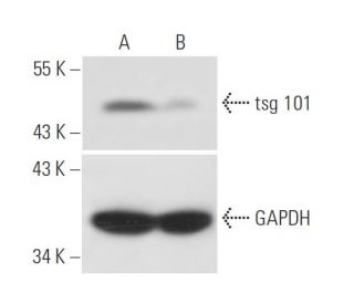 tsg 101 siRNA (h): sc-36752. Western blot analysis of tsg 101 expression in non-transfected control (A) and tsg 101 siRNA 