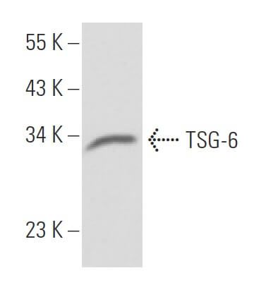 TSG-6 Antibody (A38.1.20) | SCBT - Santa Cruz Biotechnology