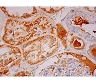 immunohistochemistry image from recommended TSG-6 (E-1) monoclonal antibody replacement. Image 293396