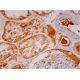 immunohistochemistry image from recommended TSG-6 (E-1) monoclonal antibody replacement. Image 293396