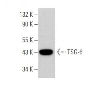 TSG-6 Antibody (D-4) - Western Blotting - Image 361516Each CRISPR/Cas9 Knockout (KO) Plasmid product consists of a pool of 3 plasmids designed to ensure identification and cleavage of a specific gene for maximum knockout efficiency. Each plasmid encodes a unique 20 nt sequence derived from the GeCKO (v2) library.