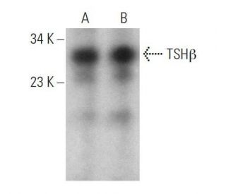 western blotting image from recommended TSH&beta; (D-6) monoclonal antibody replacement. Image 359065