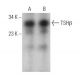 Dieser polyklonale Antikörper wird nicht mehr hergestellt. Wir empfehlen Ihnen unseren <a href="tshbeta-antibody-d-6">TSHβ (D-6)</a> monoklonalen Antikörper (Beispielsdaten werden angezeigt). western blotting image from recommended TSHβ (D-6) monoclonal antibody replacement. Image 359065