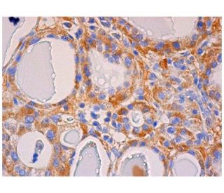 TSHR Antibody (3B12) - Immunohistochemistry - Image 284754 