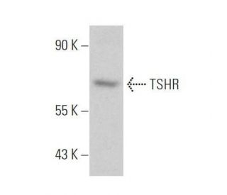 TSHR Antibody (5G225) - Western Blotting - Image 355299