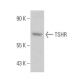 TSHR Antibody (5G225) - Western Blotting - Image 355299