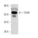 TSHR Antibody (A10) - Western Blotting - Image 14653 