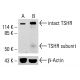 TSHR Antibody (A10) - Western Blotting - Image 413192