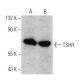 TSHR Antibody (C-10) - Western Blotting - Image 356266 