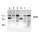 TSHR Antibody (C-10) - Western Blotting - Image 402316