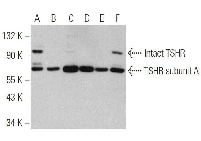 TSHR Antibody (H-155) | SCBT - Santa Cruz Biotechnology