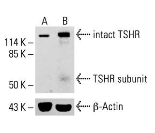 TSHR Antibody (A10) - Western Blotting - Image 413192