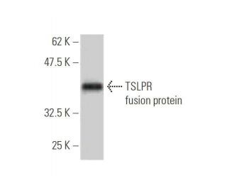 TSLPR Antibody (4A11) - Western Blotting - Image 350260
