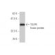 western blotting image from recommended TSLPR (4A11) monoclonal antibody replacement. Image 350260