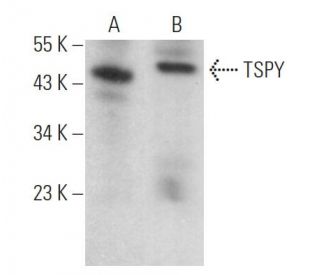 TSPY Antibody (SF-7) - Western Blotting - Image 373212 