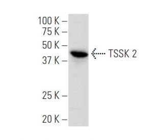TSSK 2 Antibody (S-09) - Western Blotting - Image 33810Each CRISPR/Cas9 Knockout (KO) Plasmid product consists of a pool of 3 plasmids designed to ensure identification and cleavage of a specific gene for maximum knockout efficiency. Each plasmid encodes a unique 20 nt sequence derived from the GeCKO (v2) library.