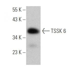 TSSK 6 Antibody (F-6) - Western Blotting - Image 372018 