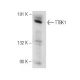 TTBK1 Antibody (B-6) - Western Blotting - Image 151215