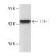 TTF-1/Thyroid Transcription Factor 1/NKX2-1 Antibody (E-4) - Western Blotting - Image 354075 