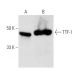 TTF-1/Thyroid Transcription Factor 1/NKX2-1 Antibody (F-12) - Western Blotting - Image 1577