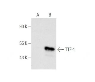 TTF-1/Thyroid Transcription Factor 1/NKX2-1 Antibody (F-12) - Western Blotting - Image 67711 