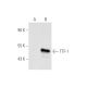 TTF-1/Thyroid Transcription Factor 1/NKX2-1 Antibody (F-12) - Western Blotting - Image 67711 