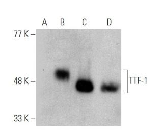 western blotting image from recommended TTF-1/Thyroid Transcription Factor 1/NKX2-1 (8G7G3/1) monoclonal antibody replacement. Image 370732