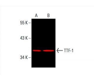 TTF-1/Thyroid Transcription Factor 1/NKX2-1 Antibody (8G7G3/1) - Western Blotting - Image 392296Each CRISPR/Cas9 Knockout (KO) Plasmid product consists of a pool of 3 plasmids designed to ensure identification and cleavage of a specific gene for maximum knockout efficiency. Each plasmid encodes a unique 20 nt sequence derived from the GeCKO (v2) library. 
