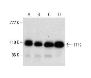 Transcription Termination Factor 2/TTF2 Antibody (M-150) - Western Blotting - Image 295939 