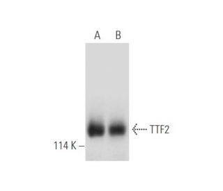 Transcription Termination Factor 2/TTF2 Antibody (B-2) - Western Blotting - Image 333678 