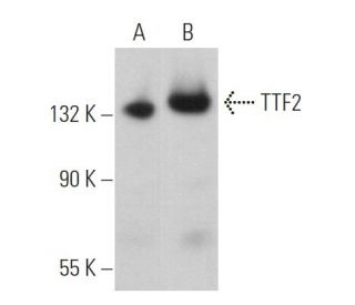 Transcription Termination Factor 2/TTF2 Antibody (B-2) - Western Blotting - Image 366599 