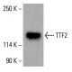 Transcription Termination Factor 2/TTF2 Antibody (B-2) - Western Blotting - Image 415844