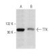 western blotting image from recommended TTK (D-8) monoclonal antibody replacement. Image 358403