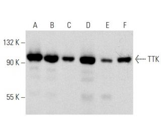 TTK Antibody (N1) - Western Blotting - Image 358371 
