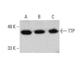 western blotting image from recommended TTP (A-8) monoclonal antibody replacement. Image 376902